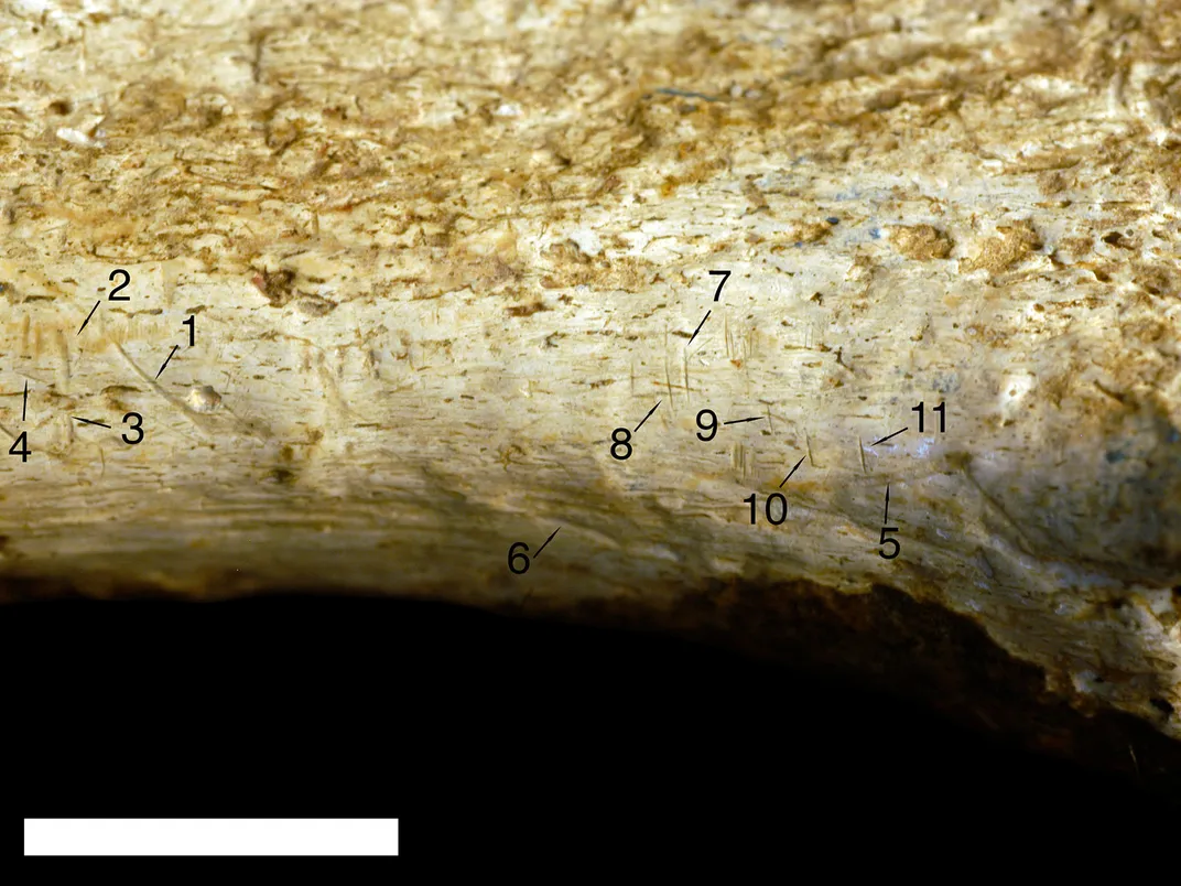 Cut and Bite Marks on Shin Bone