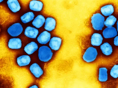 A colorized transmission electron micrograph of monkeypox virus particles.&nbsp;There have been 15,600 mpox cases and 537 deaths reported in the Democratic Republic of the Congo in 2024 so far.